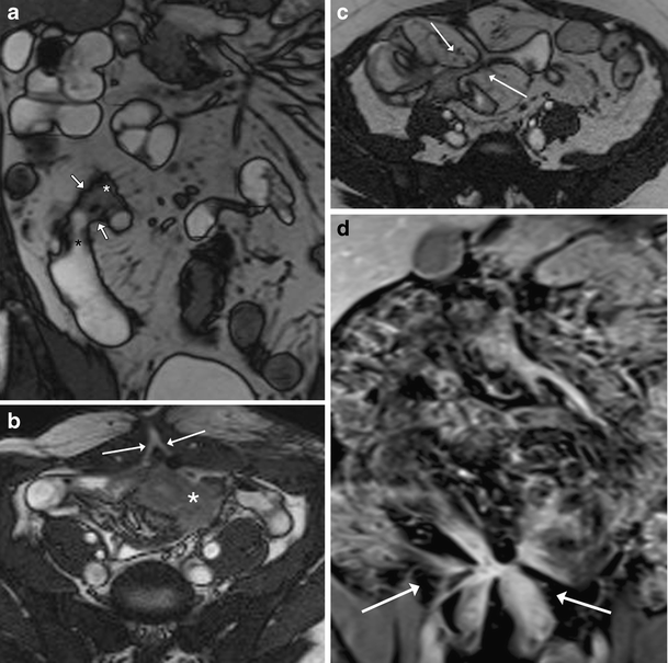 Fig. 12