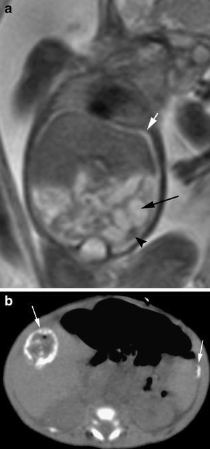 Fig. 11