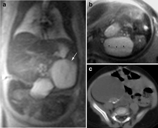 Fig. 16