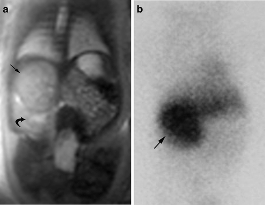 Fig. 18