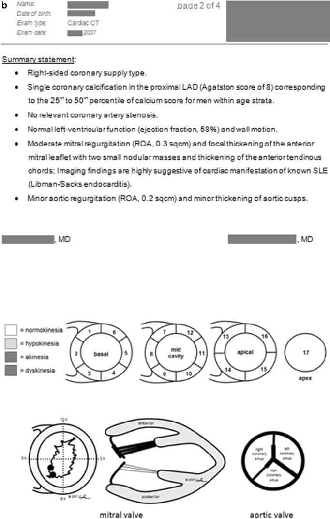 Fig. 11