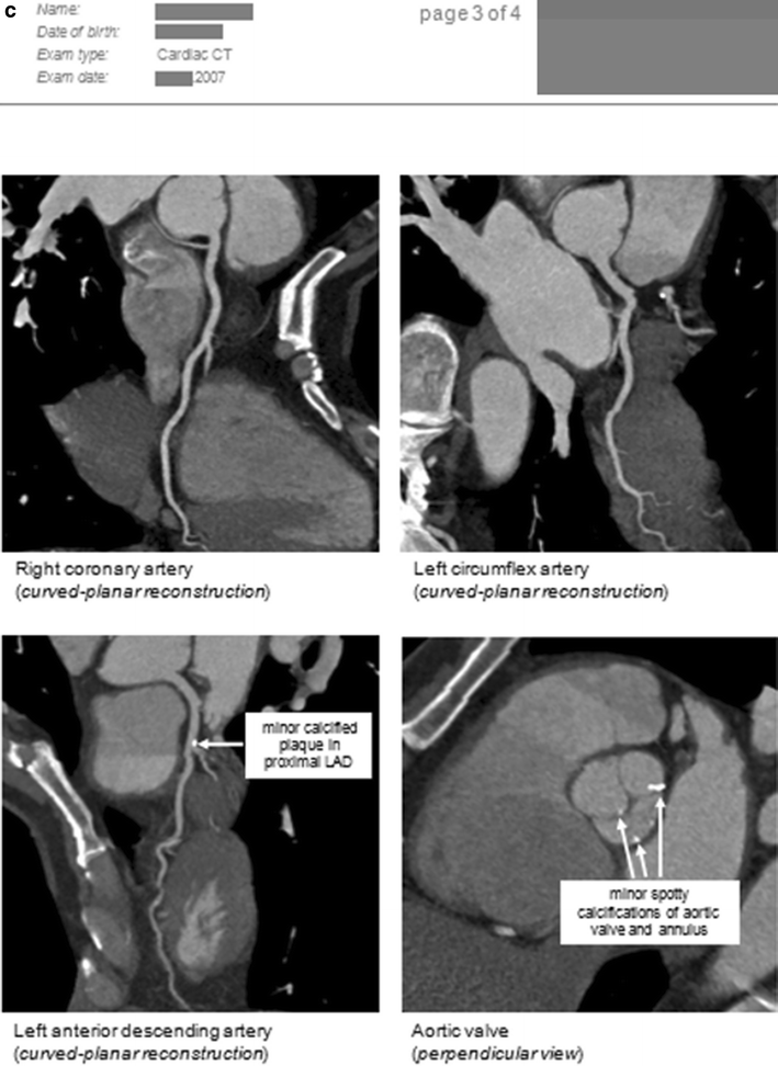 Fig. 11