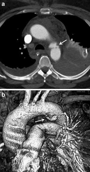 Fig. 22