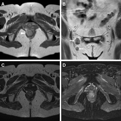 Fig. 12