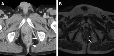 Fig. 13