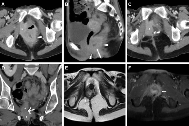 Fig. 16