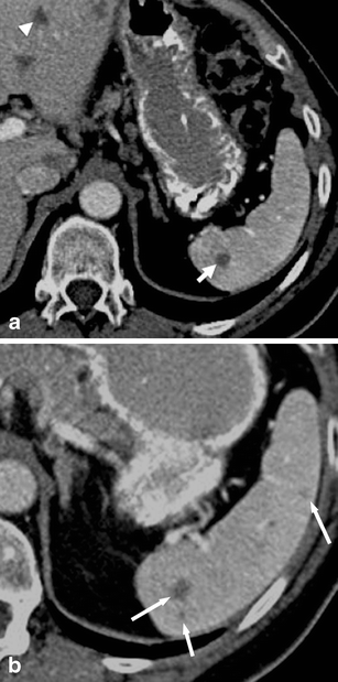 Fig. 10