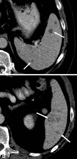 Fig. 12