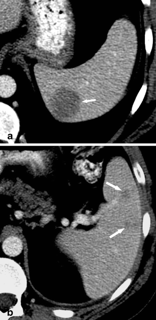 Fig. 13