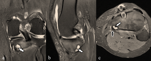 Fig. 13