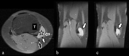 Fig. 17