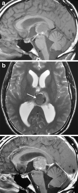 Fig. 14