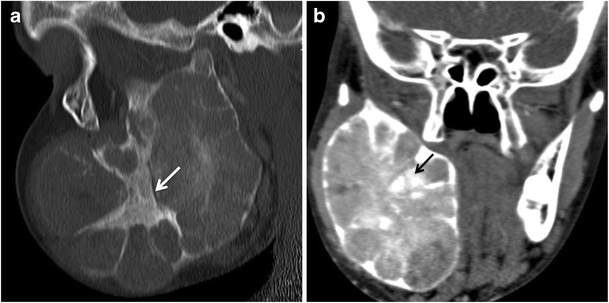 Fig. 10