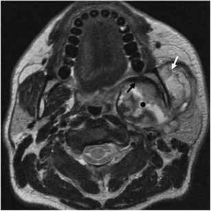 Fig. 17