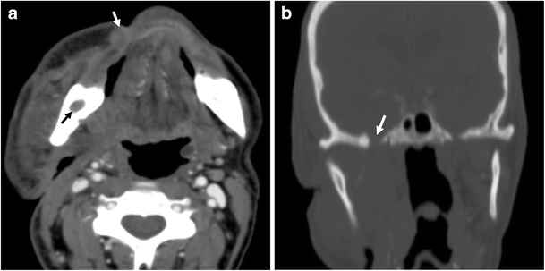 Fig. 18