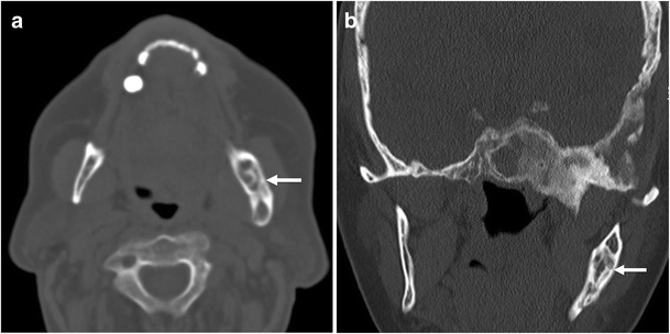 Fig. 9