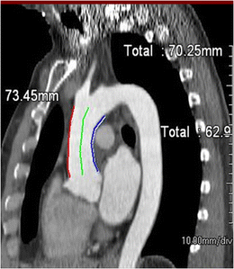 Fig. 14