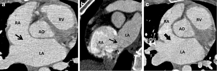 Fig. 17