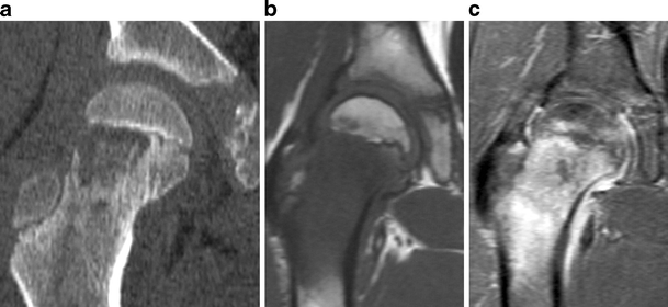 Fig. 22