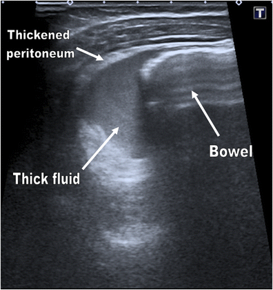 Fig. 13