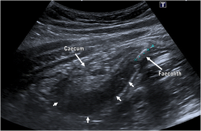 Fig. 17