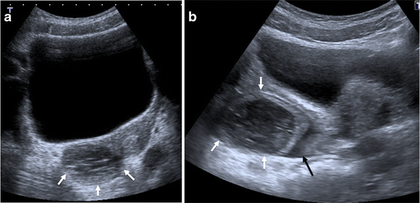 Fig. 20