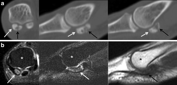 Fig. 11