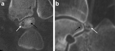 Fig. 16