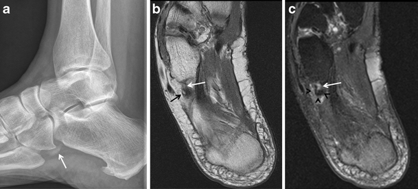 Fig. 18