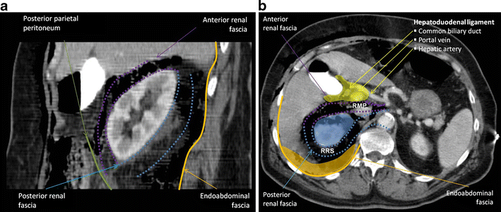 Fig. 11