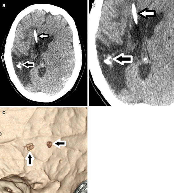 Fig. 5