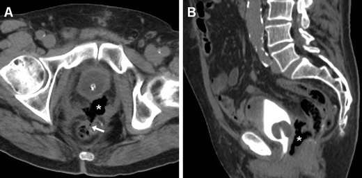 Fig. 11