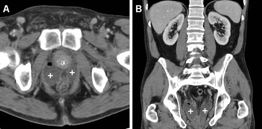 Fig. 12