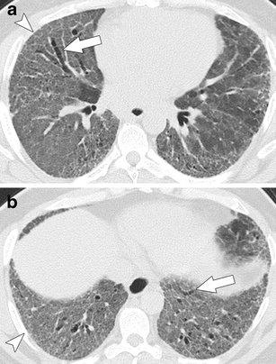 Fig. 19