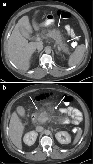 Fig. 12