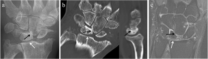 Fig. 10