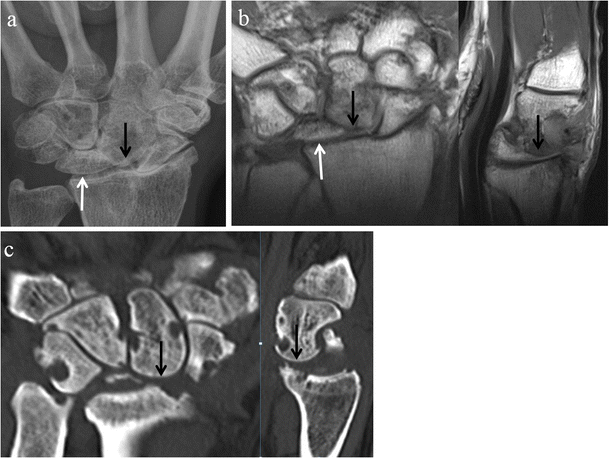 Fig. 11