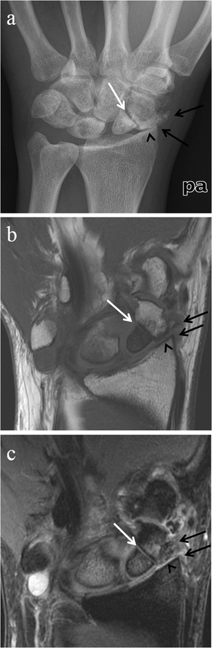 Fig. 12