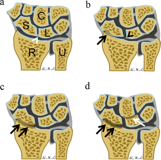 Fig. 6