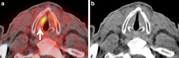 Fig. 11