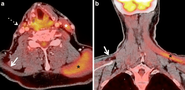 Fig. 12