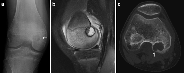 Fig. 10