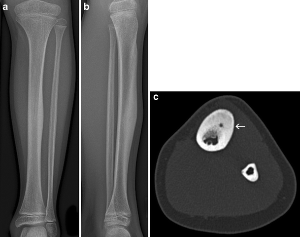 Fig. 15