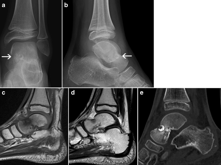 Fig. 16