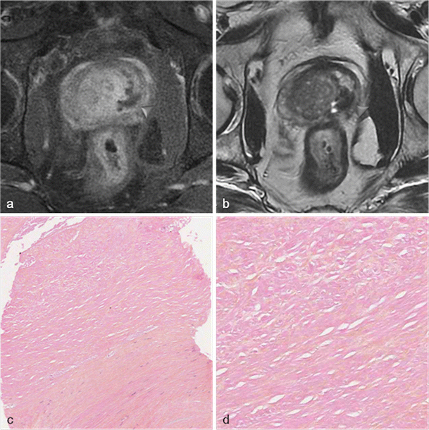 Fig. 11