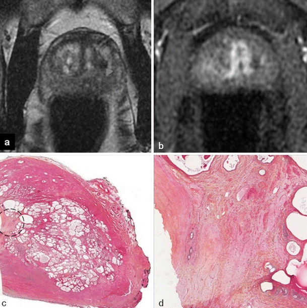 Fig. 12