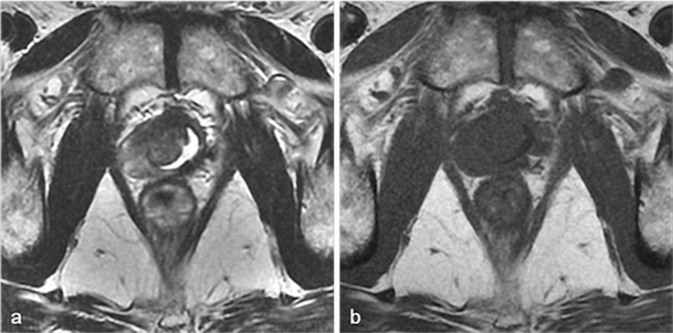 Fig. 13