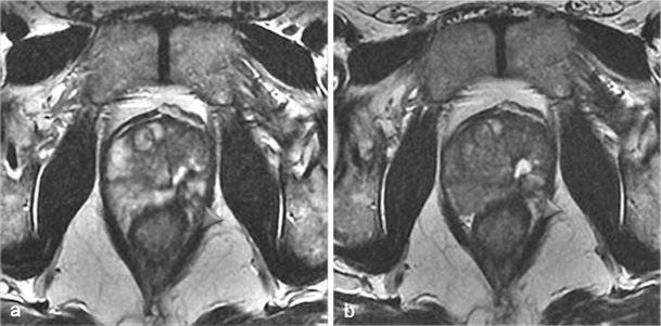 Fig. 15