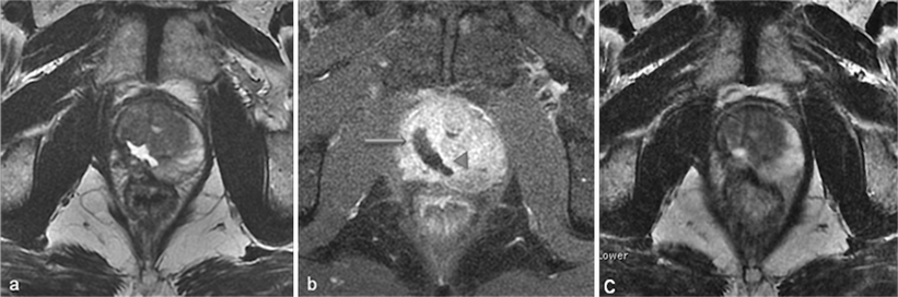 Fig. 18