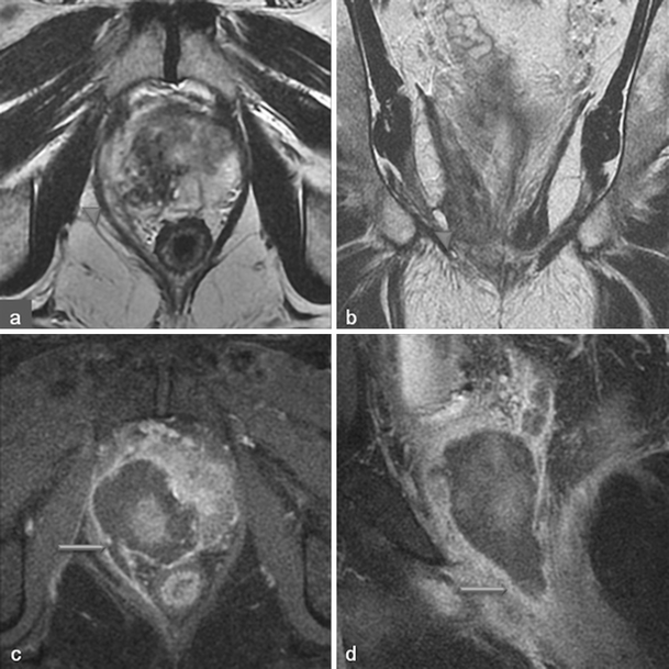 Fig. 21